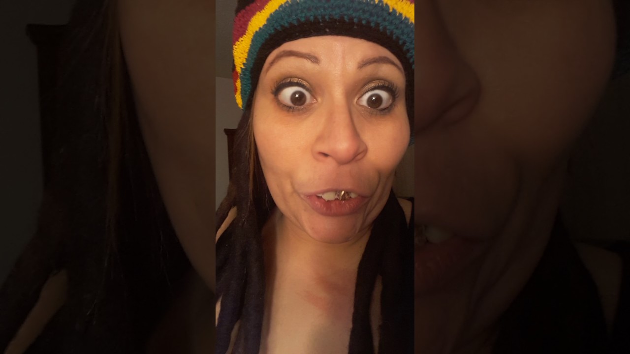 Aunty Foxy with dentist issues
