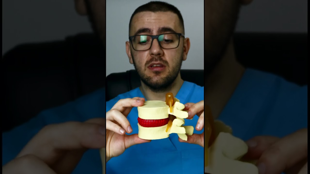 De ce se deshidratează discurile lombare #kinetoterapie