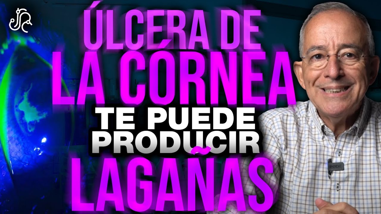ULCERA De La Cornea Te Puede Producir LAGAÑAS - Oswaldo Restrepo RSC