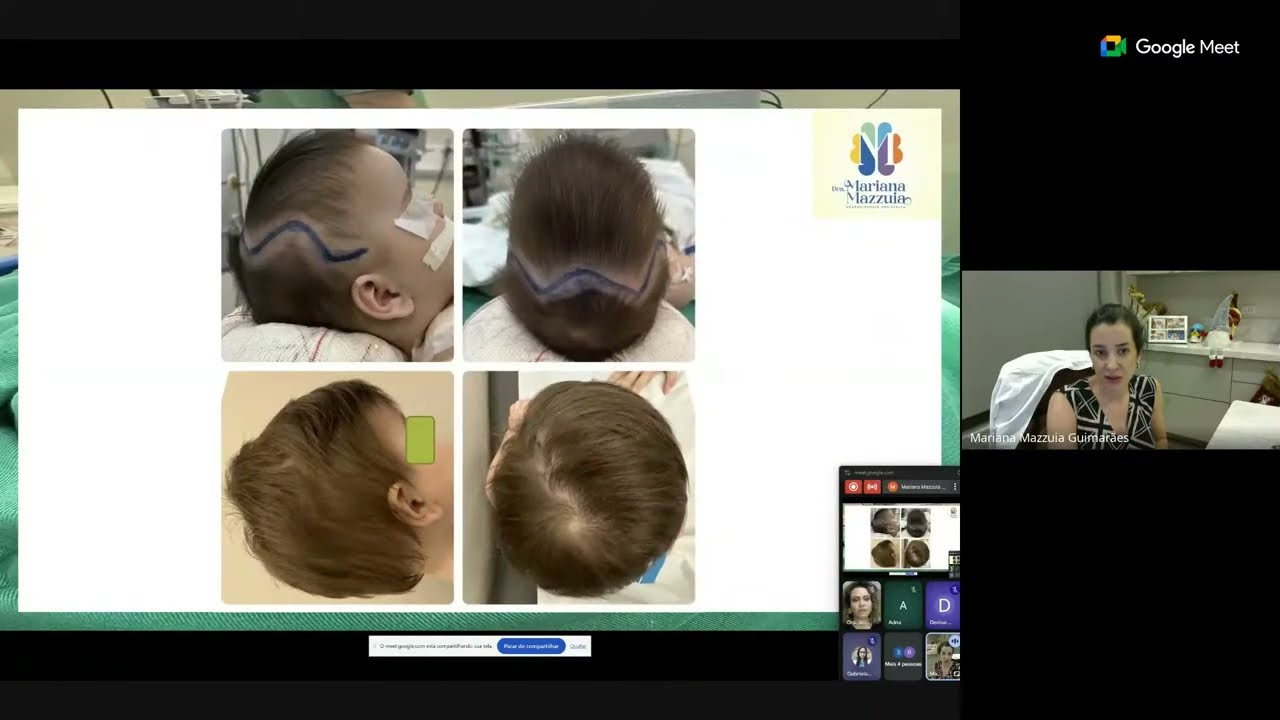 Assimetria Craniana Posicional e Cranioestenose: da identificação ao tratamento