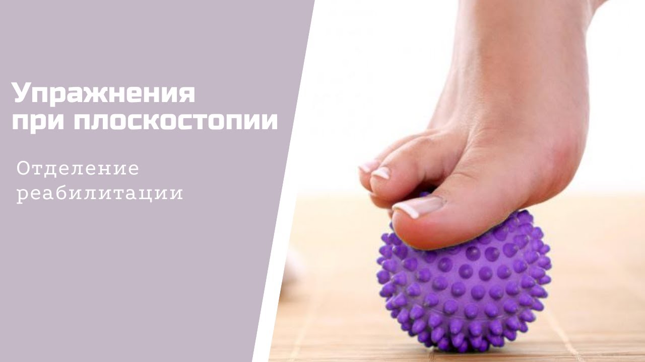 Комплекс упражнений ЛФК для профилактики и лечения плоскостопия