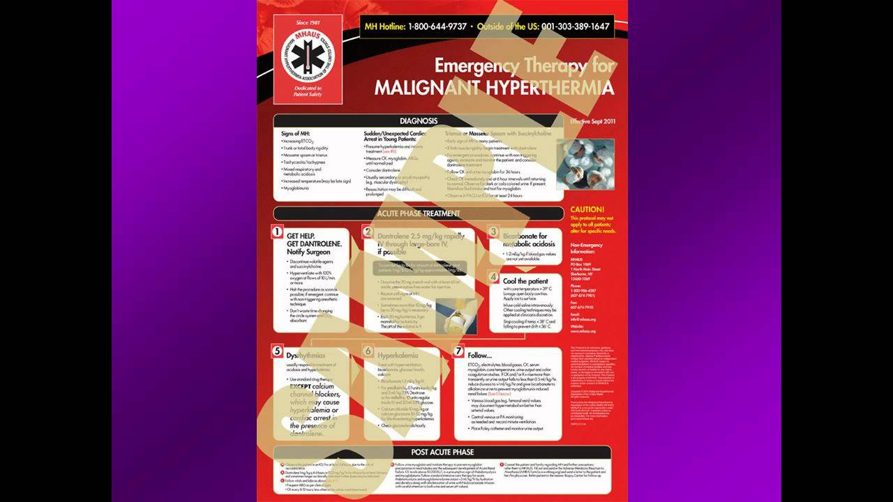Malignant Hyperthermia Overview