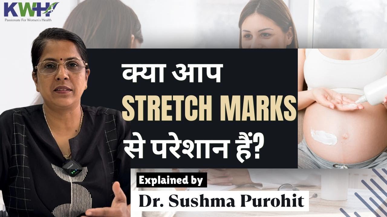 क्या आप Stretch Marks से परेशान हैं? — Explained by Dr. Sushma Purohit