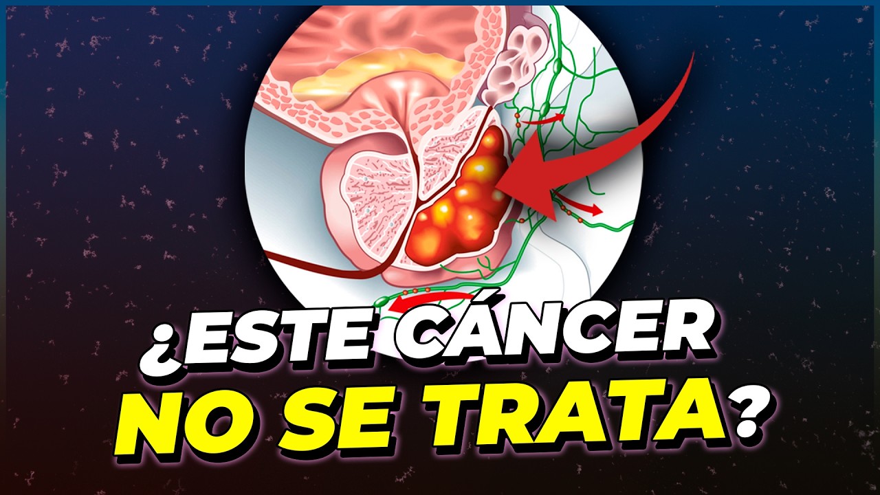 Vigilancia Activa: Cuándo NO SE TRATA Un CÁNCER DE PRÓSTATA