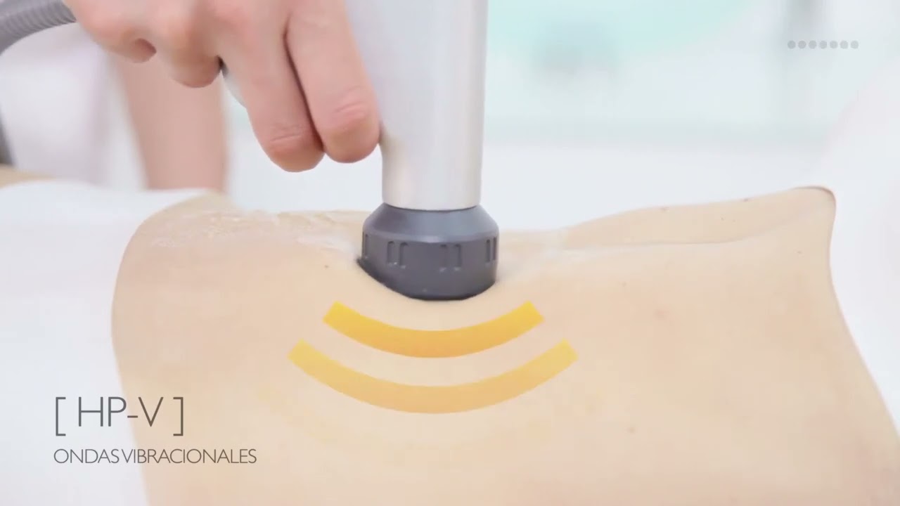 Tratamiento de Ondas de choque Vmat Pro para eliminar la celulitis