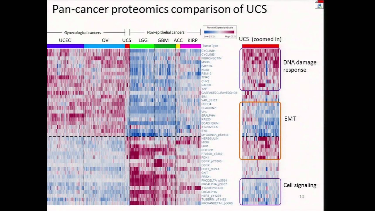 Integrated Molecular Characterization of Uterine Carcinosarcoma - Rehan Akbani