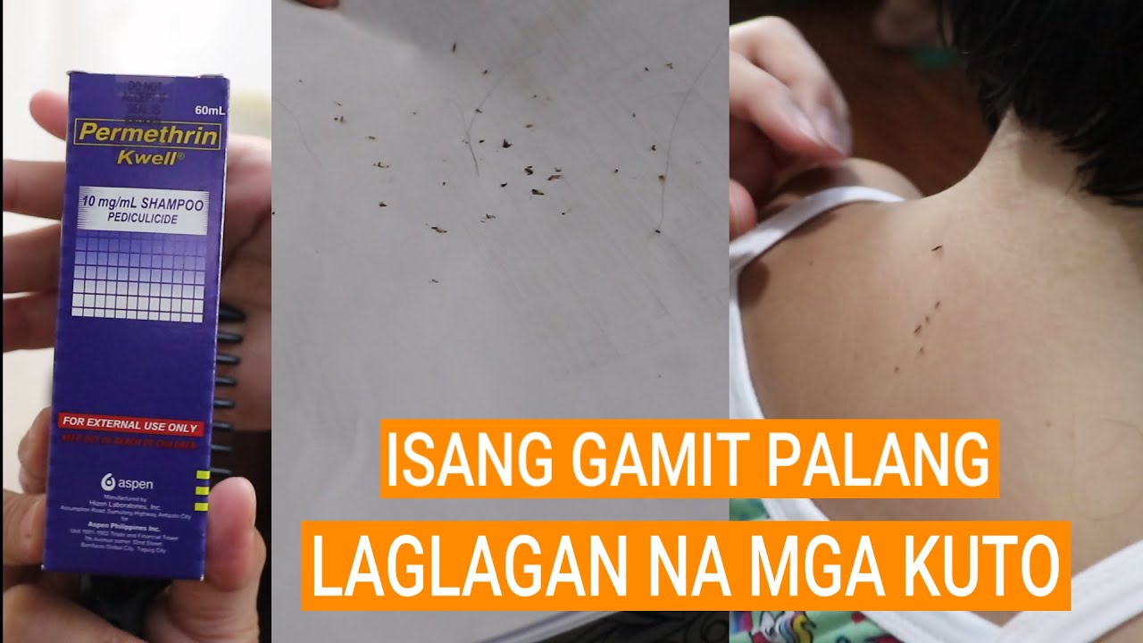 KWELL SHAMPOO UNBOX AND REVIEW │KUTO TREATMENT│PANTANGGAL SA KUTO