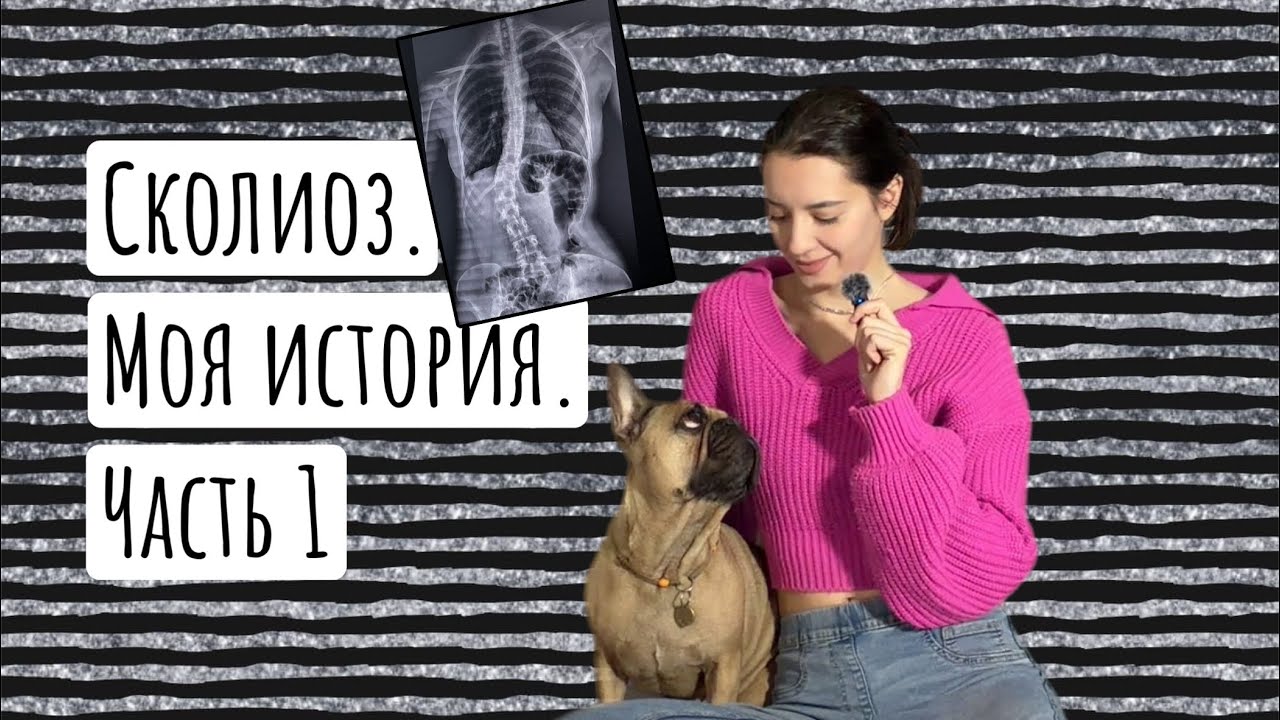 Операция | сколиоз | подготовка 