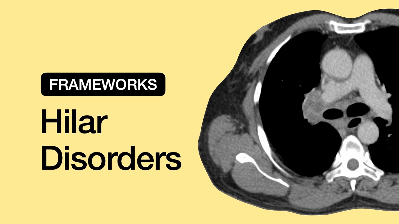 Hilar Disorders | Chest Radiology Essentials