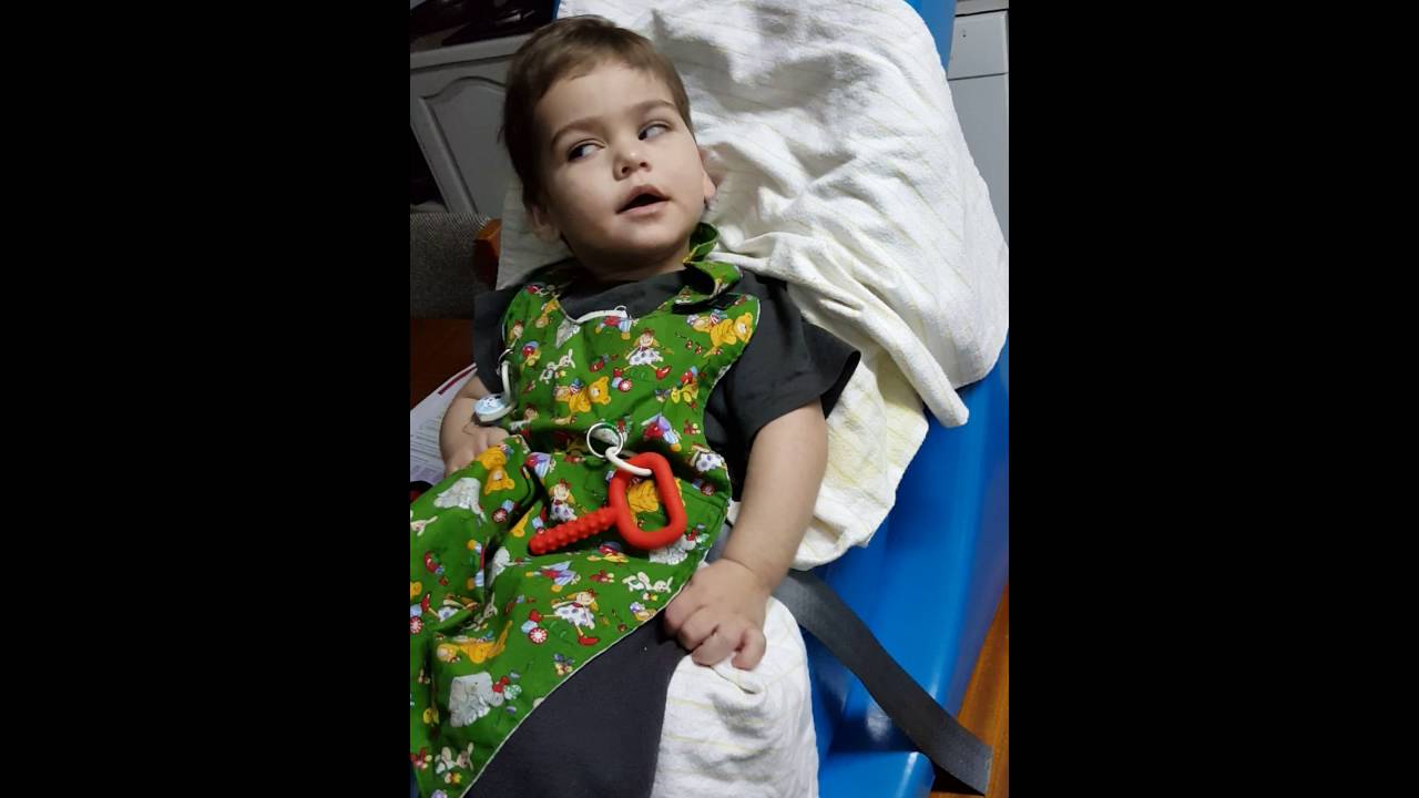 CDKL5 seizure