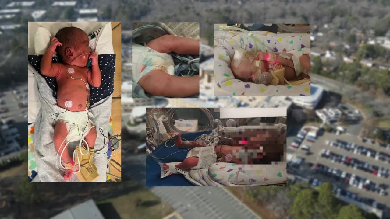 Doc sounded alarm about babies with fractures. Why wasn't CPS called right away?