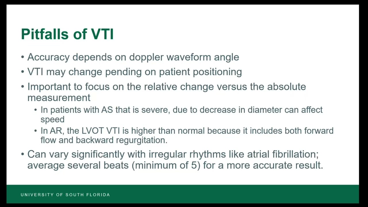 VTI: A Hemodynamic Assessment Tool