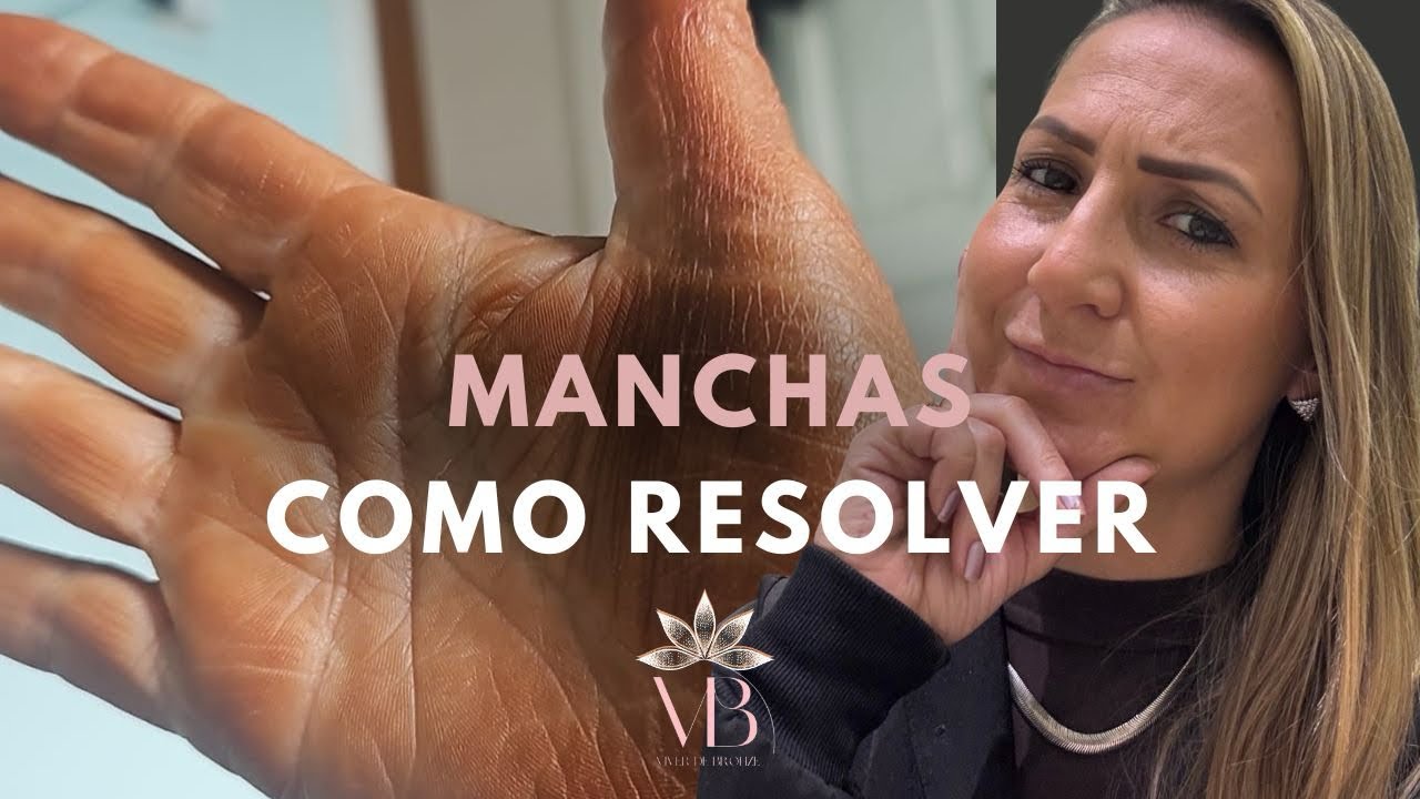 Bronzeamento artificial e manchas. Como resolver