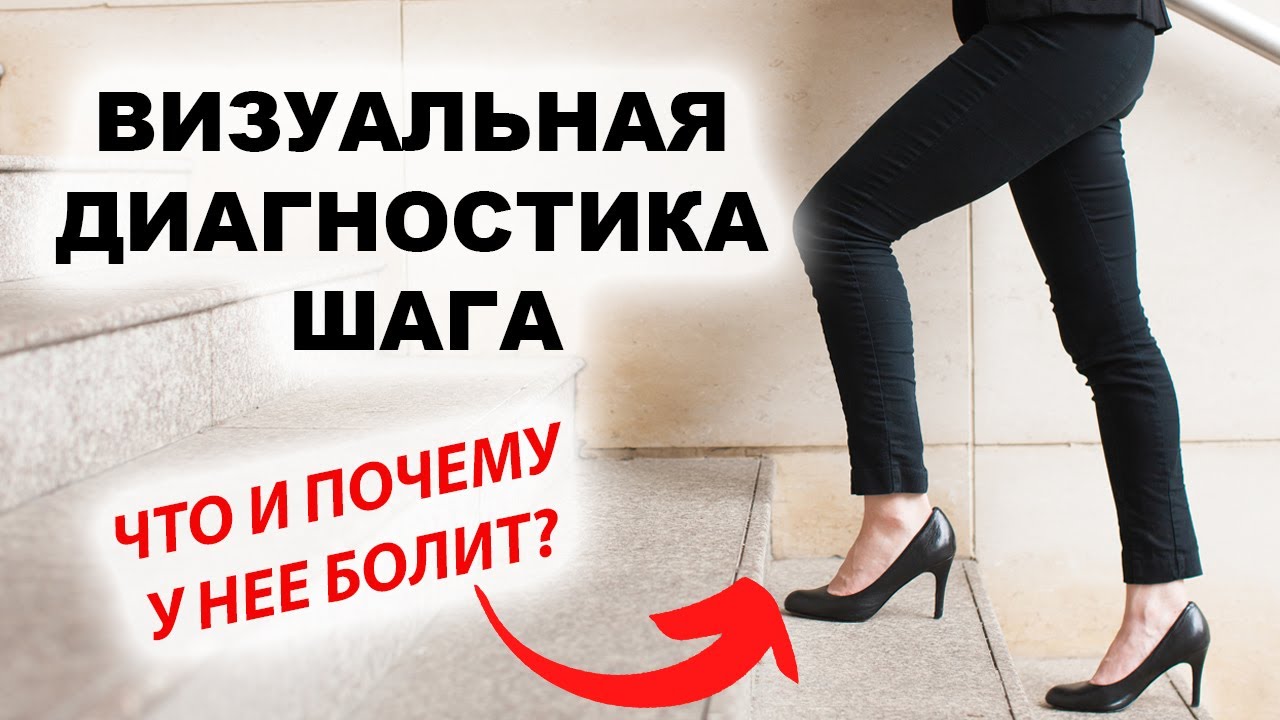 Как по походке найти нарушения? Разбор пациента на семинаре Глеба Кирдогло.
