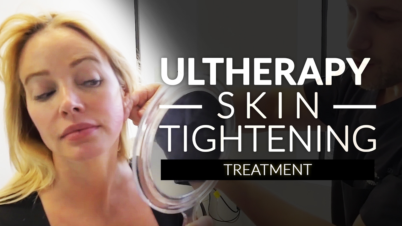 Ultherapy Skin Tightening Beverly Hills, CA  / Neck, Jaw, Eyebrow and lid Lifting With Ultrasound