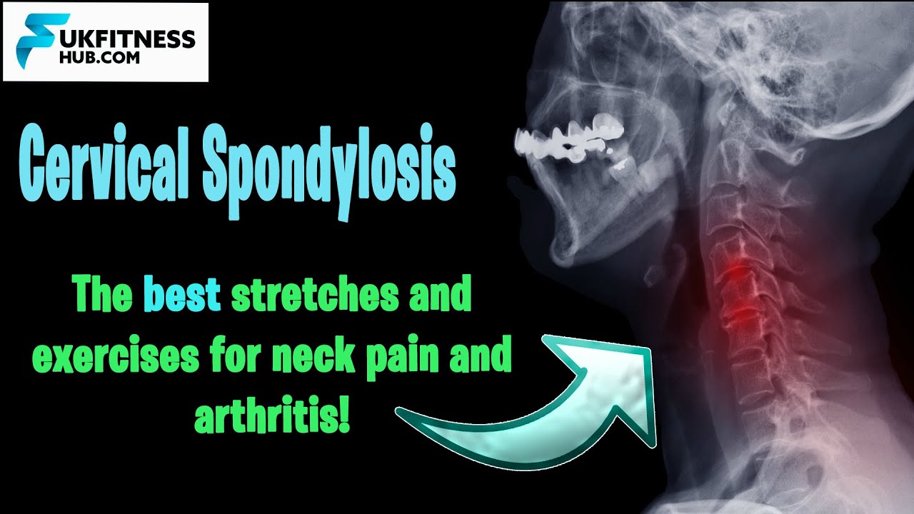 The Best Stetches and Exercises for Cervical Spondylosis and Neck Arthritis - Full Management Plan