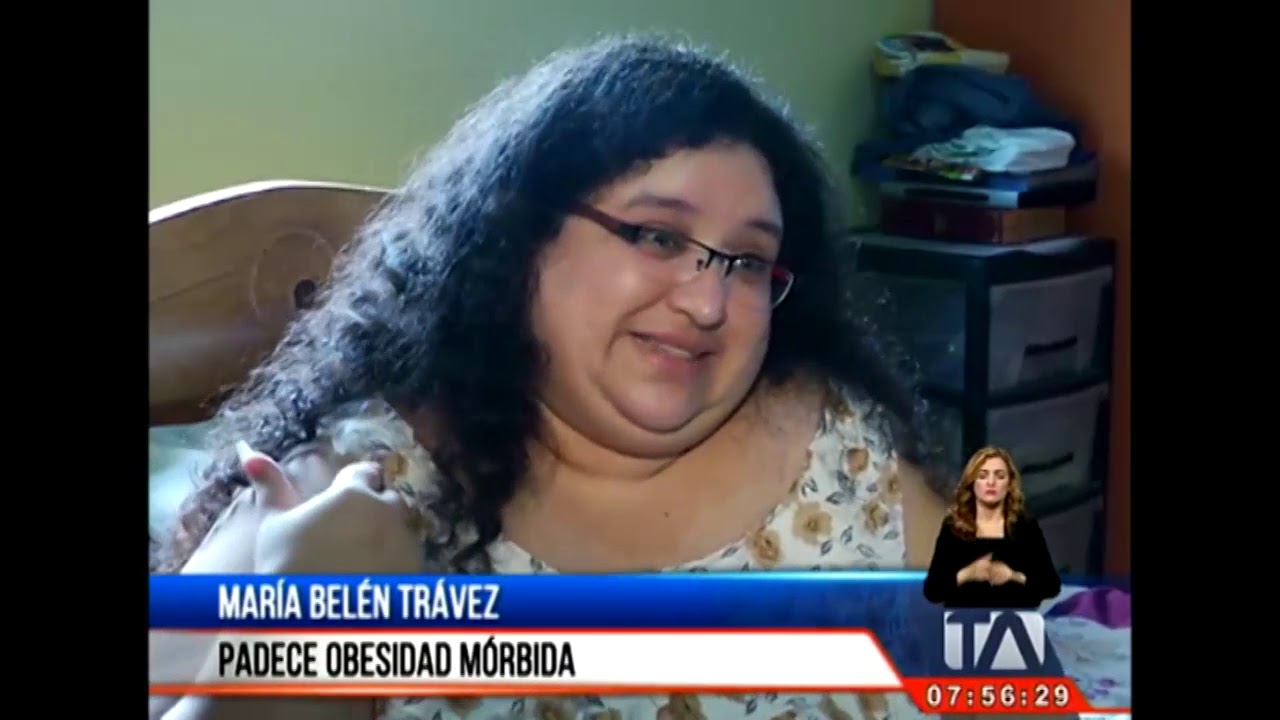Una mujer de 34 años que sufre de obesidad mórbida clama por su ayuda -Teleamazonas