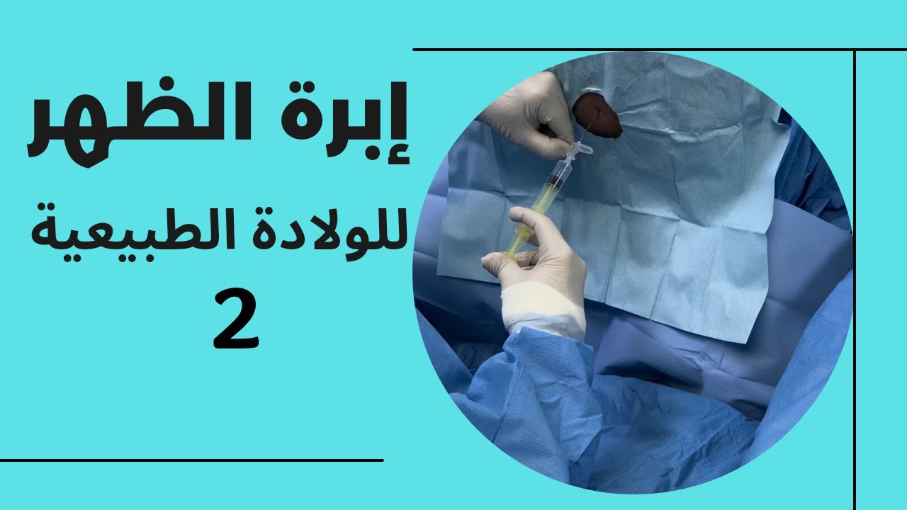 إبرة الظهر للولادة الطبيعية بدون ألم جزء ٢ #فتحي_هرهره