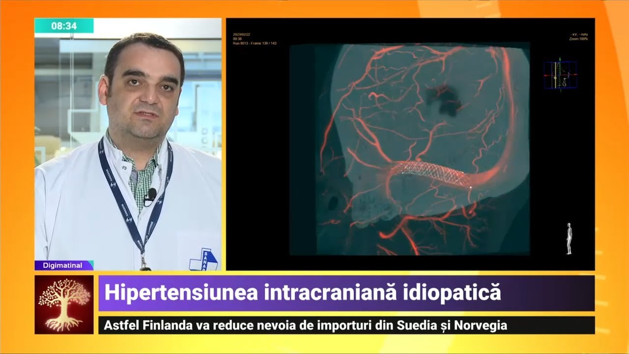 Hipertensiunea intracraniană idiopatică – Dr. Cristian Mihalea | Spitalul Clinic SANADOR