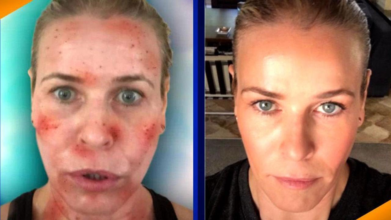 Beauty Confidential: Star Laser Secrets