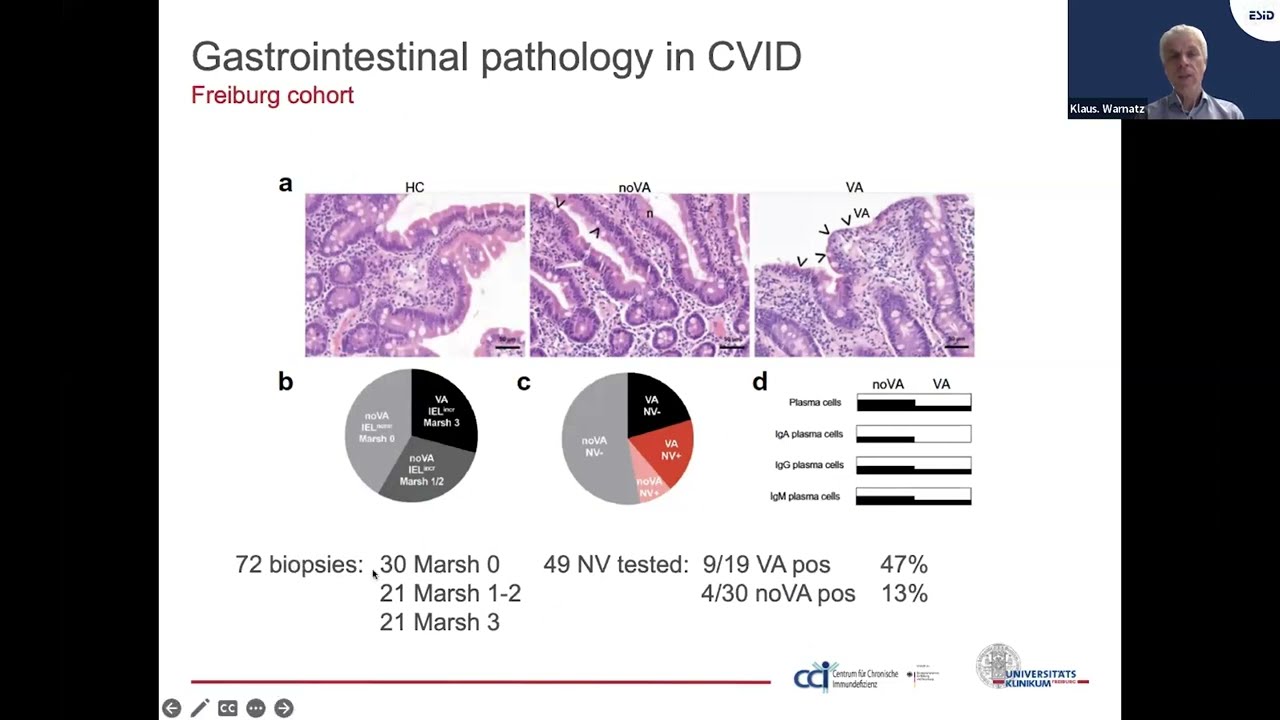 ESID Grand Rounds 21: Gastrointestinal complications in CVID from pathology to management