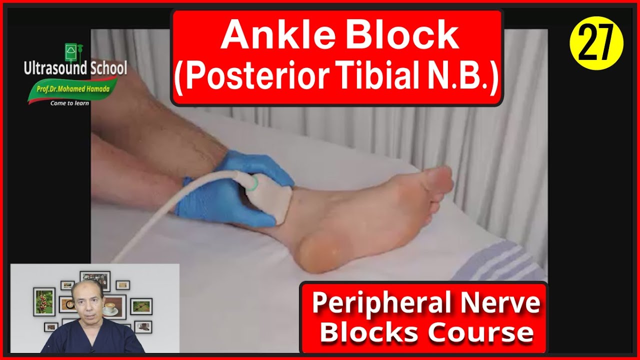 Ankle Block (Posterior Tibial Nerve Block) ) |Mohamed Hamada|(27)