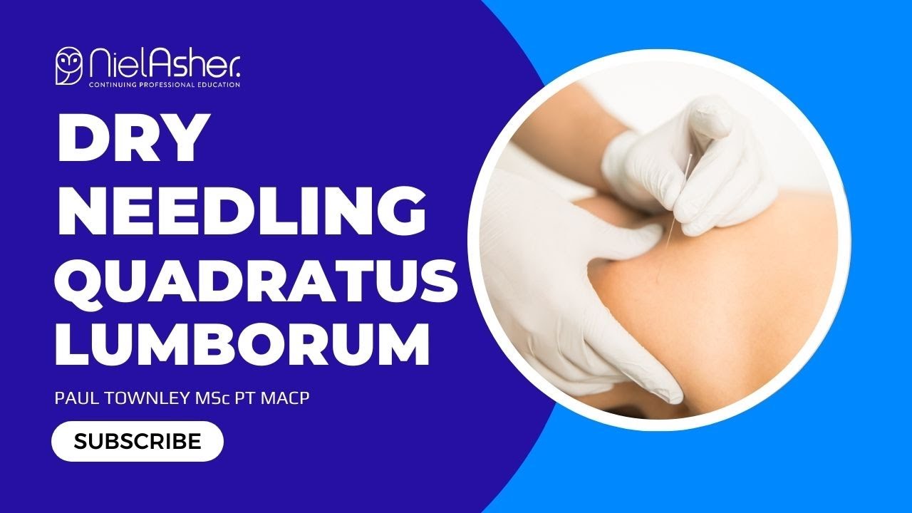 How To Dry Needle Quadratus Lumborom