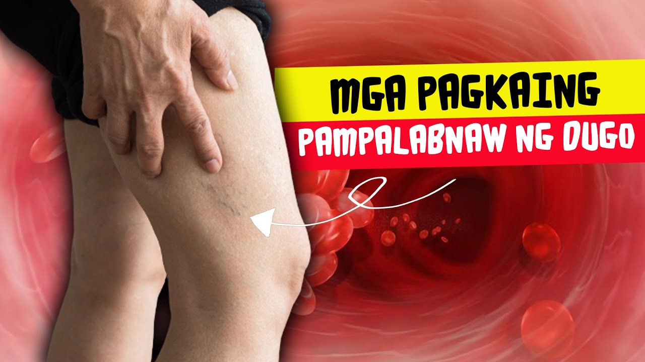 8 Pagkaing Pampalabnaw Ng Dugo | 8 Natural Blood Thinning Foods To Prevent Blood Clot