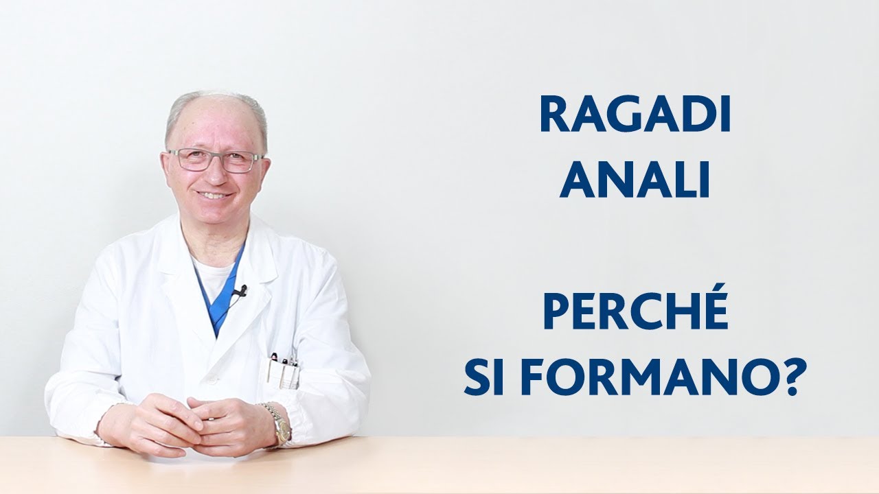 Ragadi anali: cosa sono e quali sono le cause