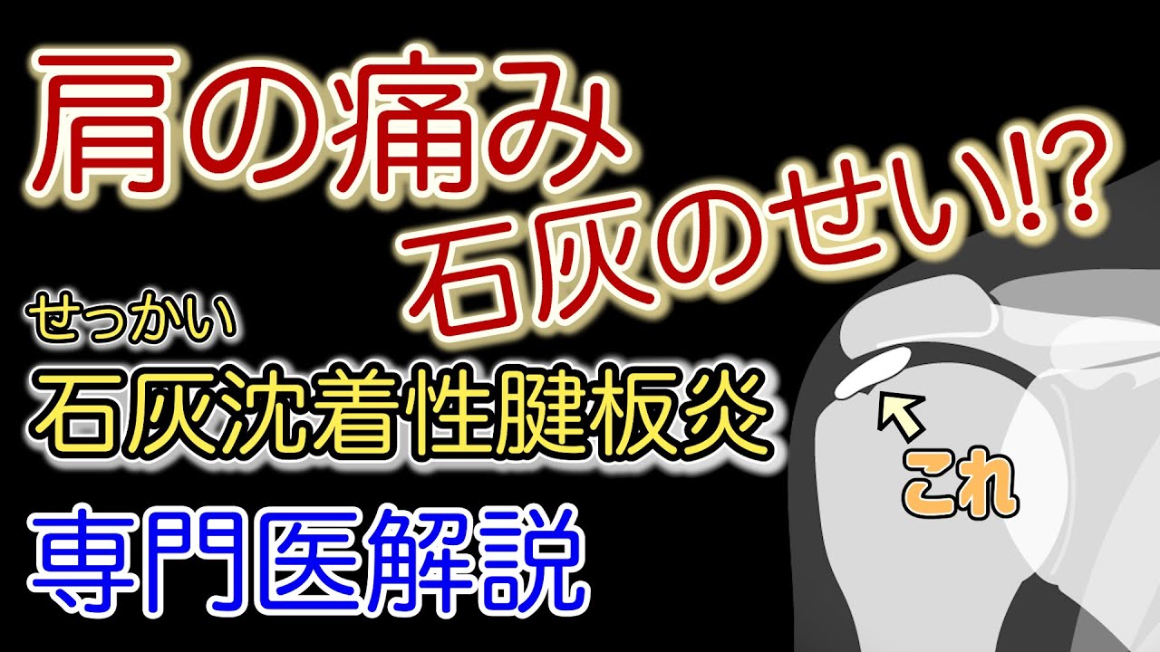 【専門医解説】肩の石灰、石灰沈着性腱板炎