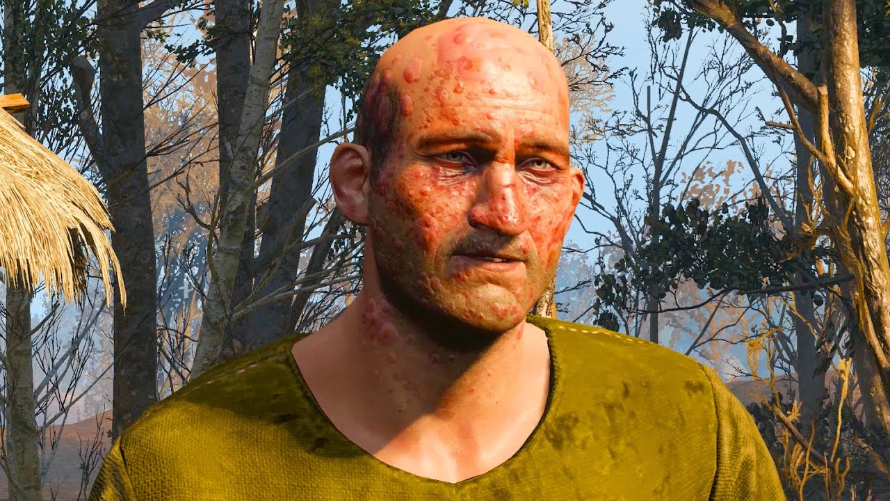 Hazardous Goods: Geralt Kills and Burns Gert Borel (Witcher 3 | Velen Quest & Aftermath)