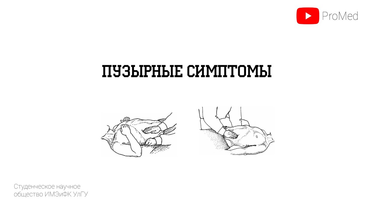 Пузырные симптомы