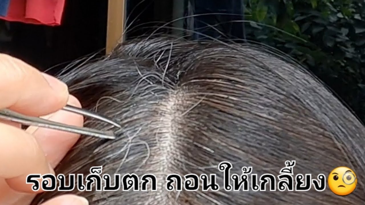 มีให้ถอนตลอด เริ่มจะถอนเองไม่ไหวแระ🙄 #ถอนผมหงอก  #ถอนผมขาว #ถอนผมหงอกเอง
