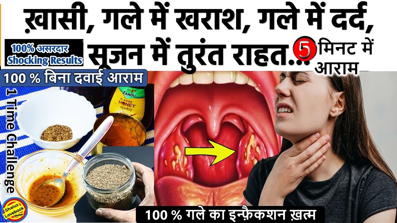 गले में सूजन, ख़ासी, ख़राश, Infection तुरंत ठीक करने के 2 रामबाण तरीके- Throat Infection home remedies