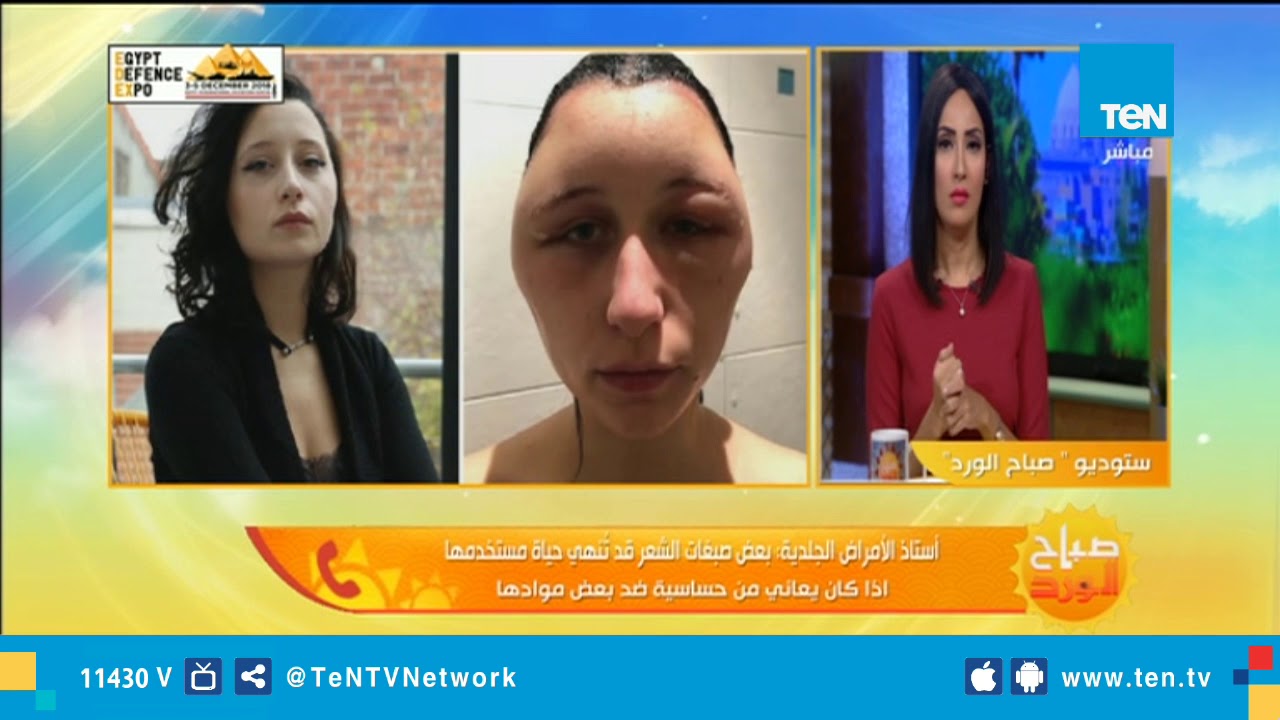 أستاذ أمراض جلدية 