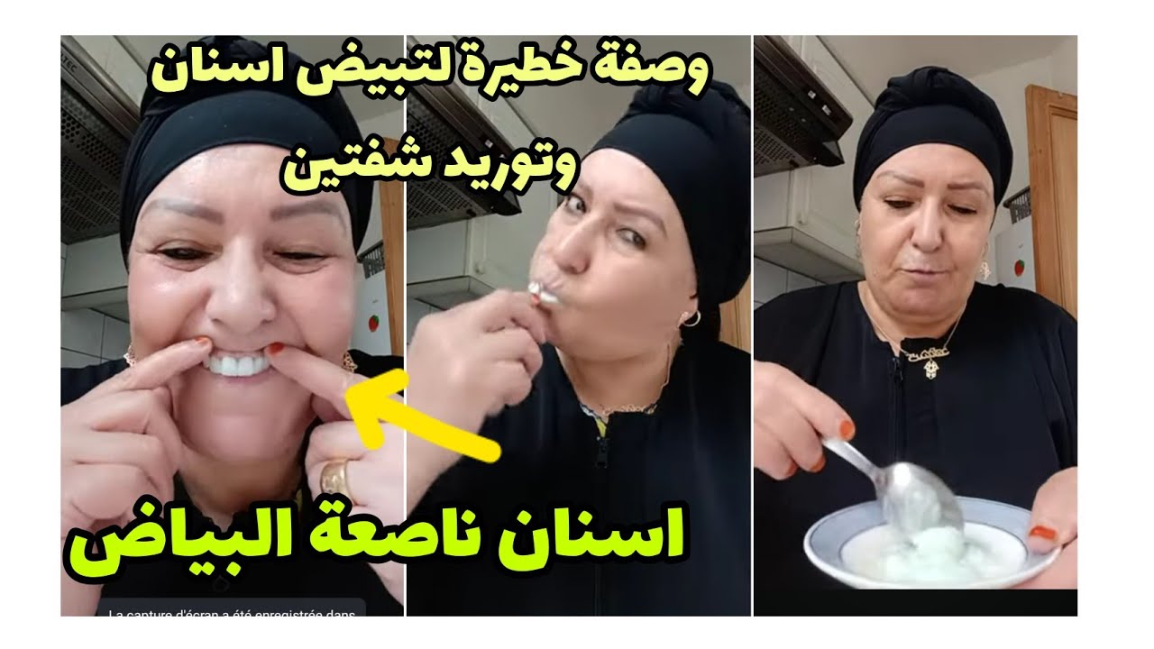 في دقيقه اسنانك غتولي بيضاء كثلج ستغنك عن طبيب اسنان وابتسامة ناصعه تزيل اصفرار وتسقط الجير علاج لثه
