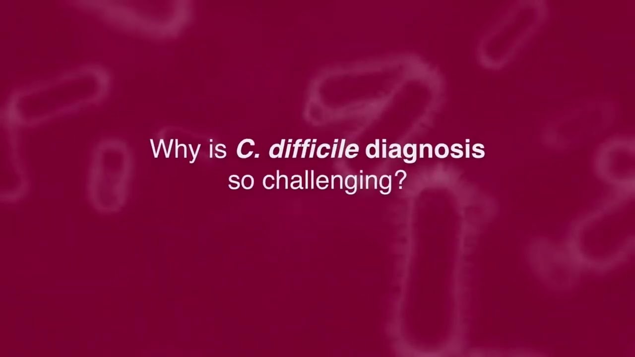 Challenges of 𝘊. 𝘥𝘪𝘧𝘧𝘪𝘤𝘪𝘭𝘦 diagnosis