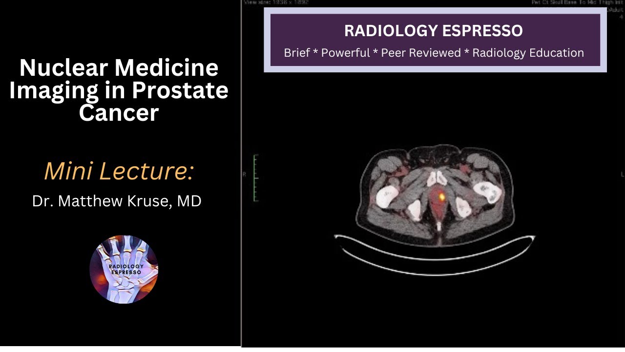 NUCLEAR MEDICINE IMAGING IN PROSTATE CANCER: Mini Lecture, Dr. Matthew Kruse