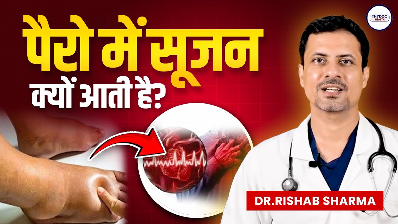 पैरों में सूजन क्यों आती है? पैरों में सूजन के मुख्य कारण | Pairo ki Sujan Ku aati ?
