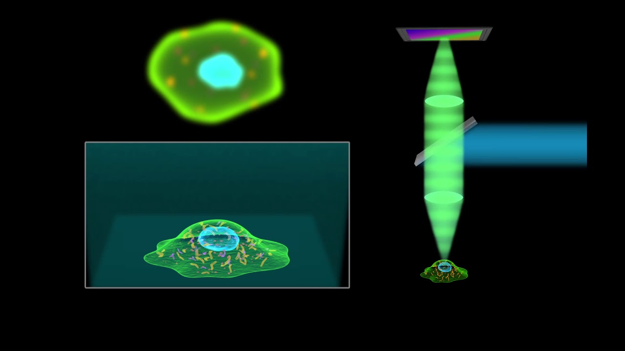 Spinning Disk Confocal 