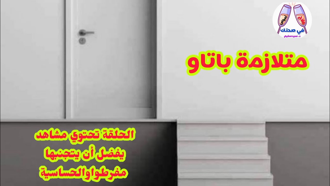 متلازمة باتاو