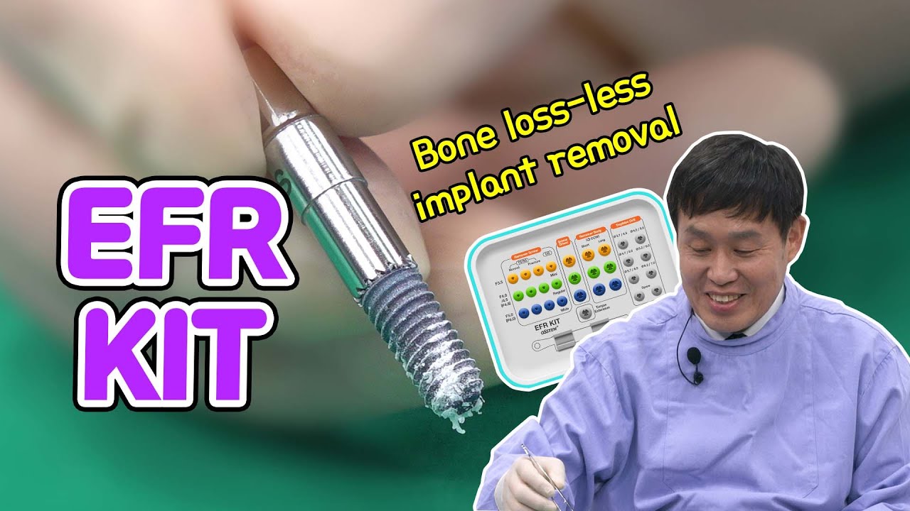 [EASY Hands-on] EFR KIT - #45 #46 Implant Removal