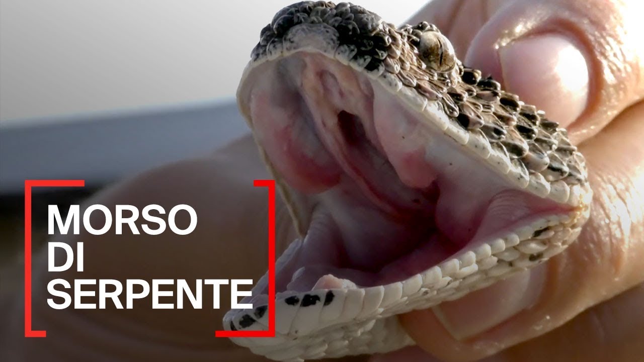 Morsi di serpente: ogni anno 5,4 milioni di persone colpite