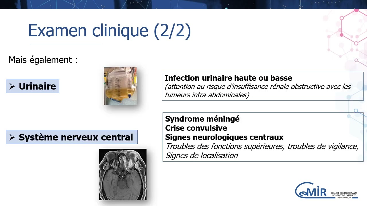 7 44 1 Fièvre chez l’immunodéprimé