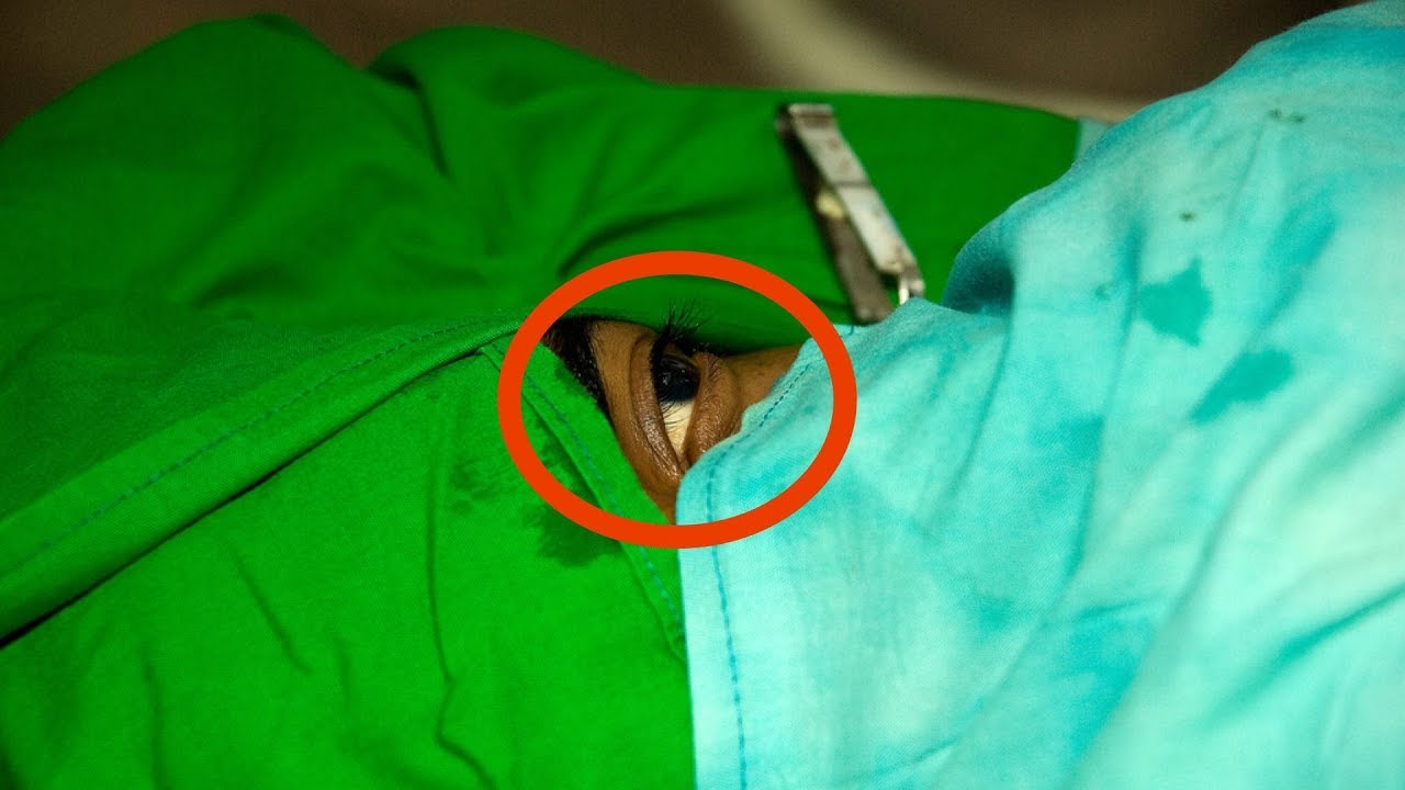Cette mère retire le bandage de son fils. Puis, il f...