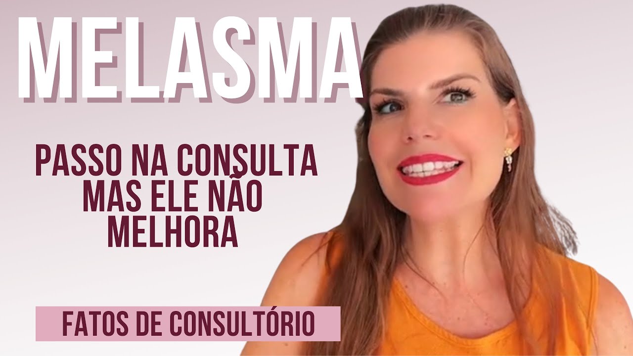 7 motivos de consultório do melasma não melhorar - minha experiência