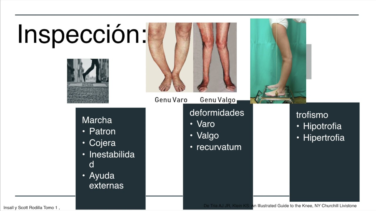 Exploración Física de Rodilla