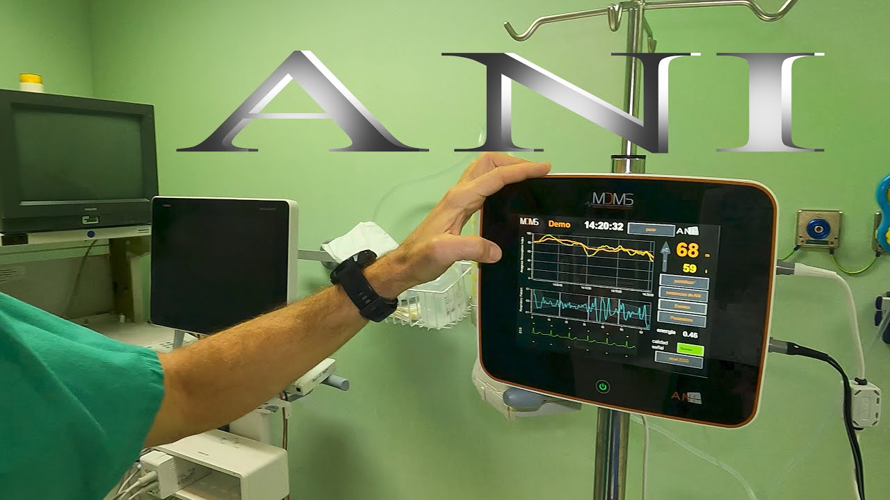 Monitor ANI
