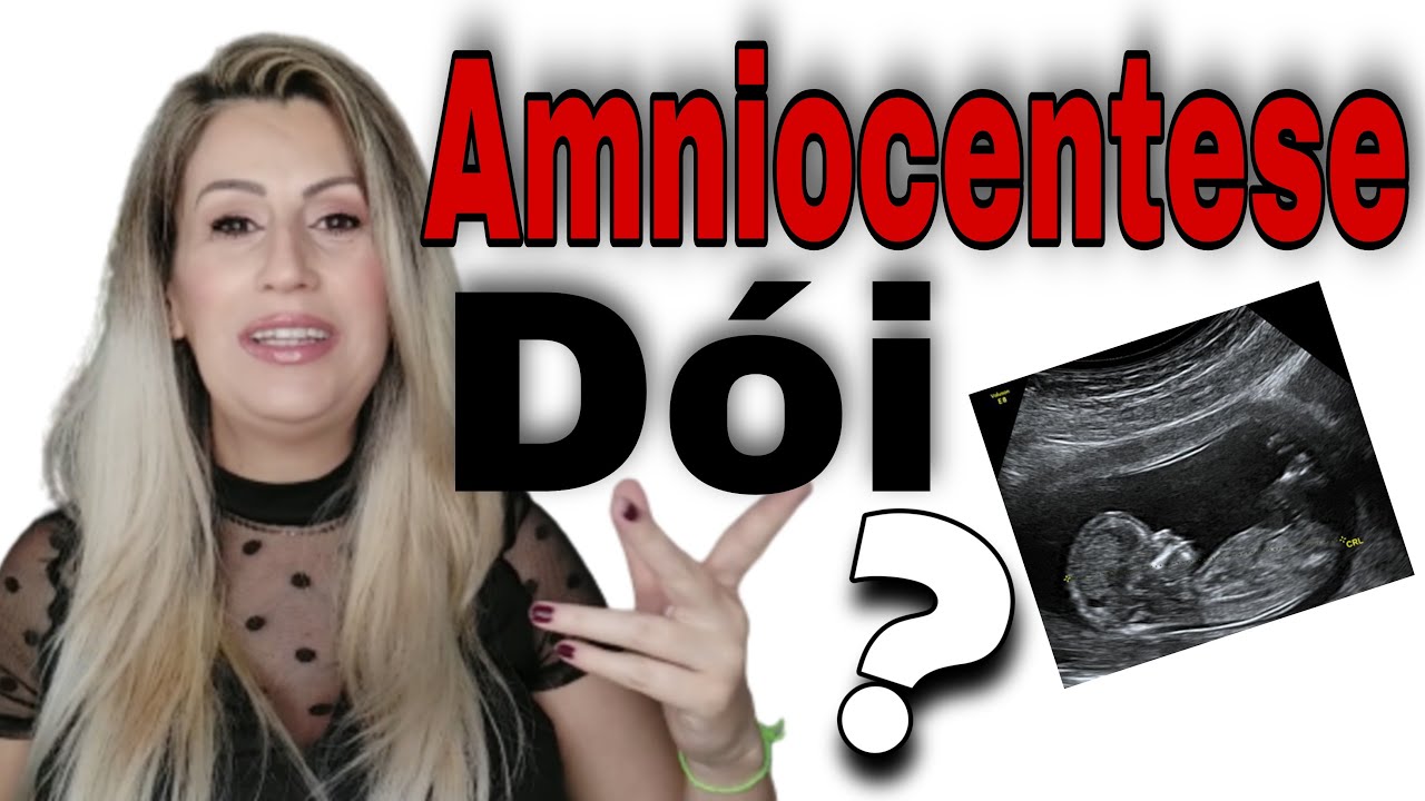 AMNIOCENTESE DOI ?