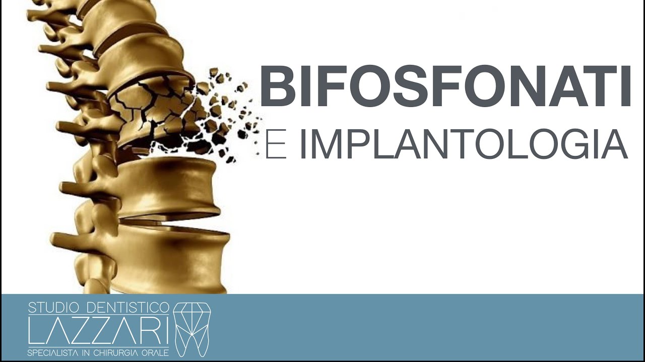 Implantologia dentale e bifosfonati